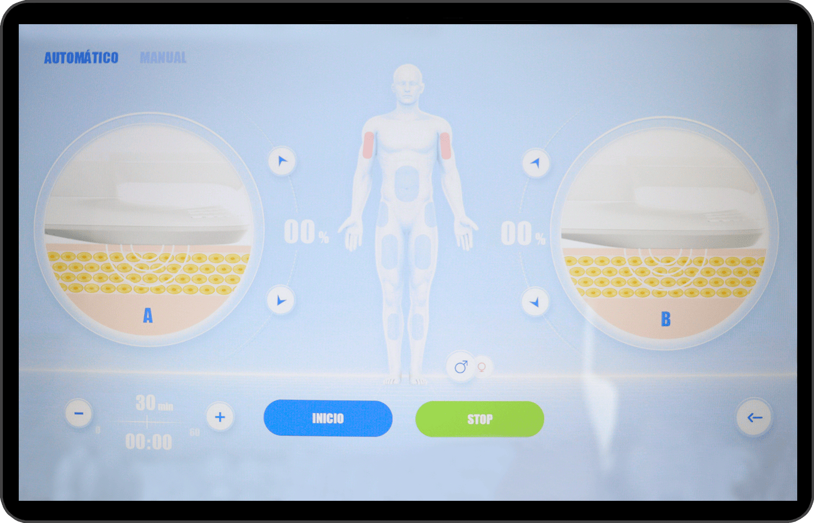 cryolipolysis-cold-sculptor-m40-ultra-21c-cold-sculptor-m40-ultra-21c machine